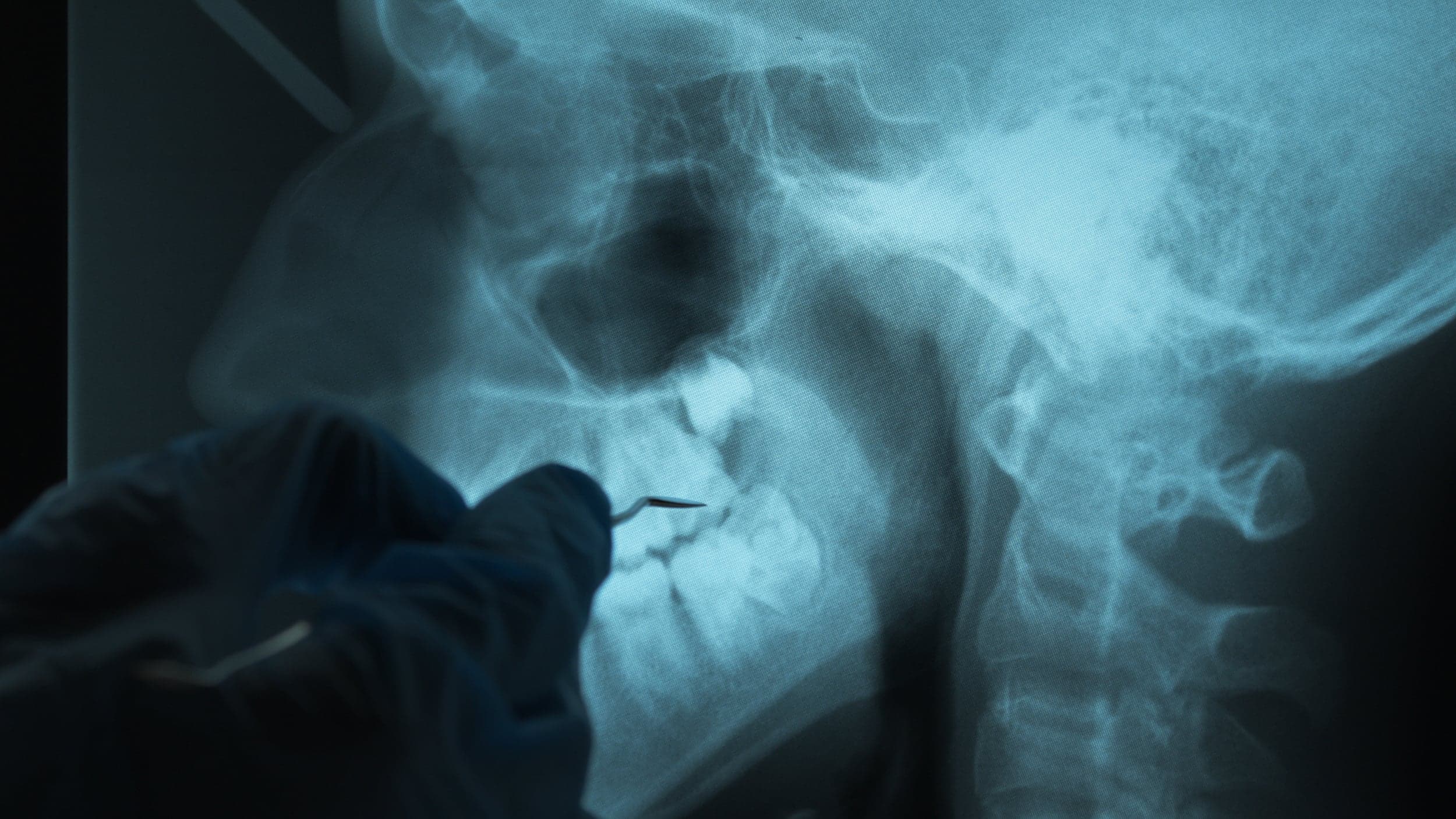 MedTech Distribution